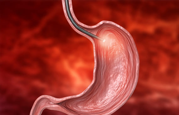 Endoscopista